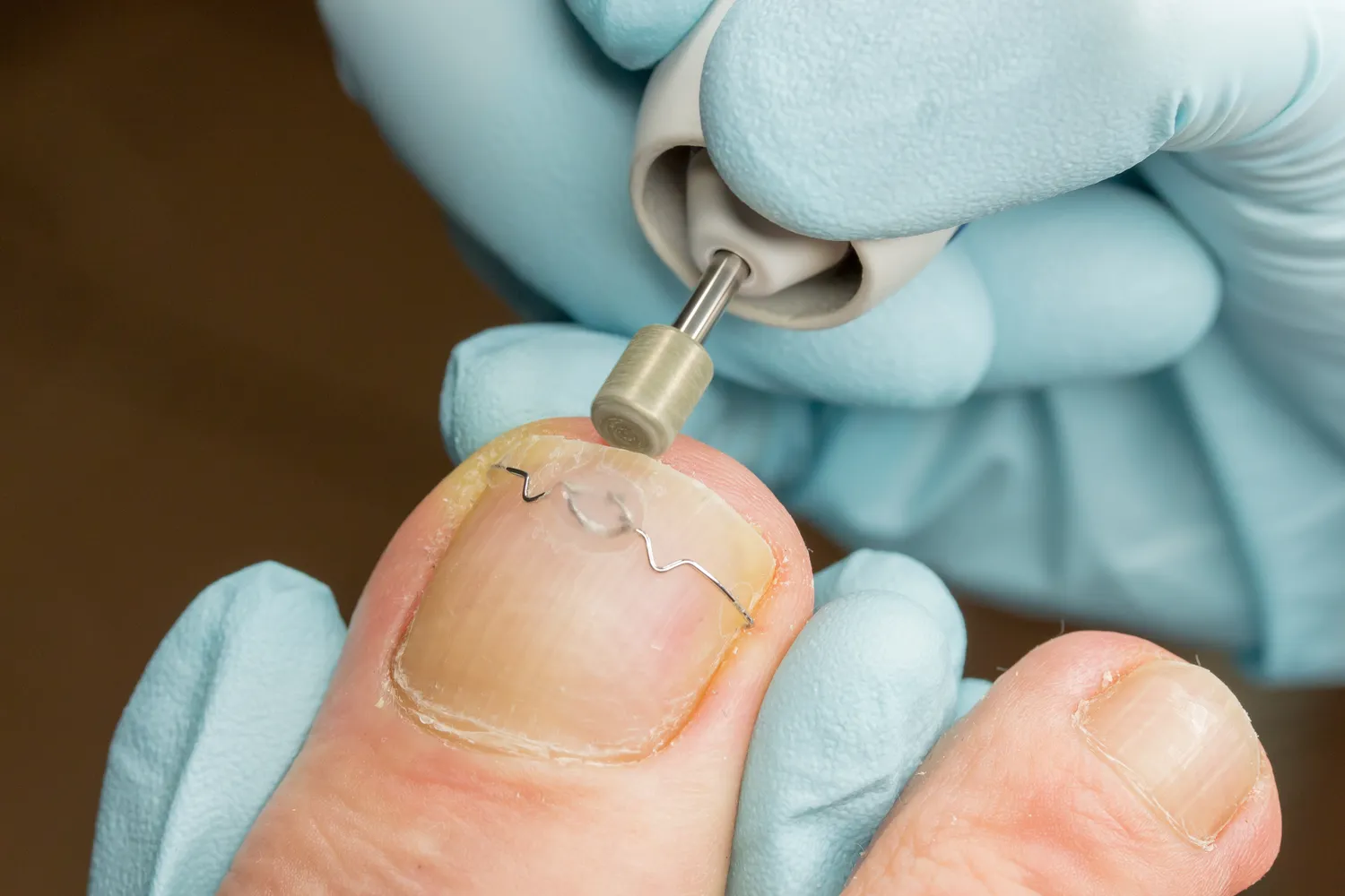 Podologia - czym jest i kiedy warto udać się do podologa?