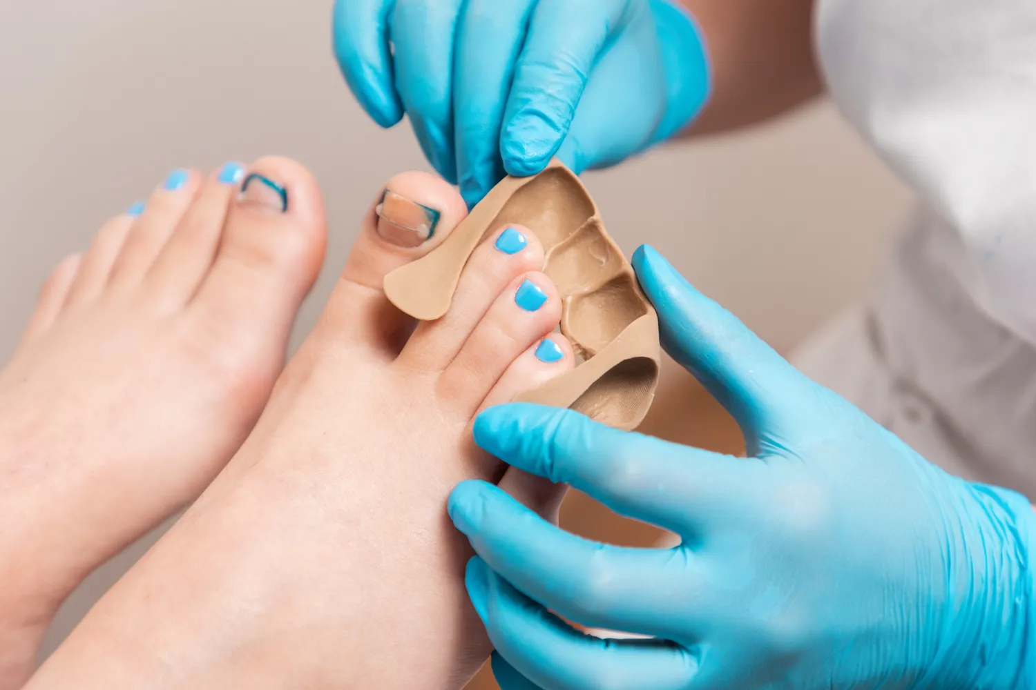 Pedicure leczniczy - czym jest, jak wygląda, kiedy warto go wybrać?