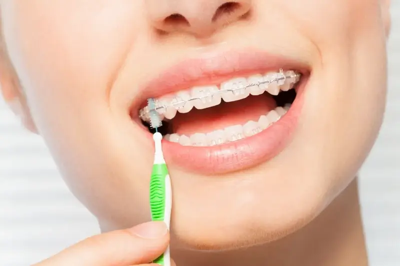 Dlaczego regularne wizyty u dentysty są tak ważne?